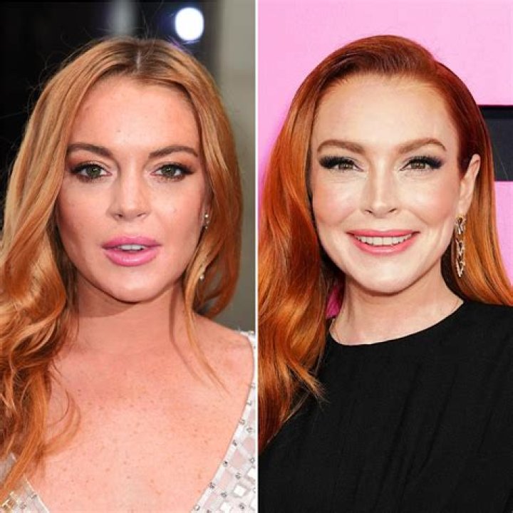 
Lindsey Married At First Sight Plastic Surgery | Before And After Photos 