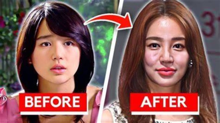 What Happened To Betsy Woodruff Face? Did She Undergo Jaw Surgery?