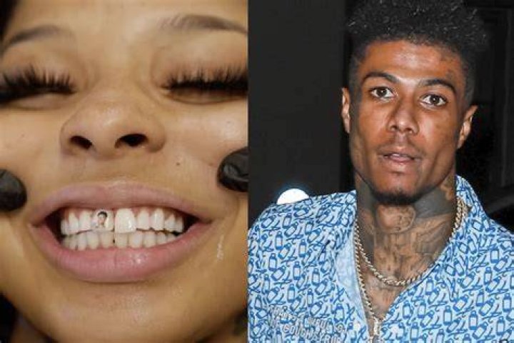What Happened To Chrisean Rock’s Tooth? Everything To Know About The Rapper