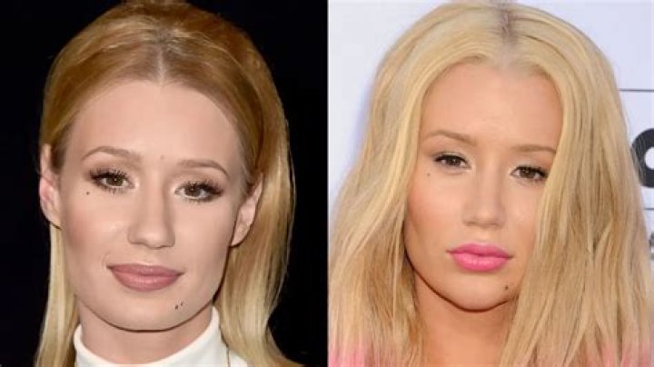 What Happened To Iggy Azalea And Why Is She Taking A Break? Status Update On The Singer