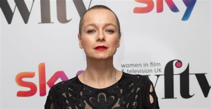 Why Is Samantha Morton Bald? Actress Health Related Problems And Short Hair Details